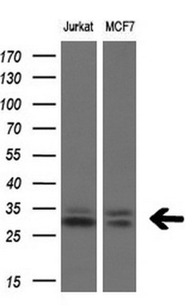 TGIF1 Antibody in Western Blot (WB)