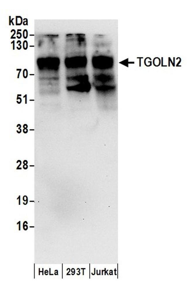 TGOLN2 Antibody in Western Blot (WB)