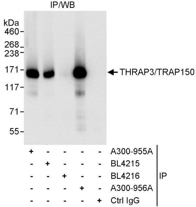 THRAP3/TRAP150 Antibody in Immunoprecipitation (IP)