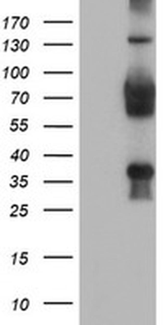 TLE2 Antibody in Western Blot (WB)