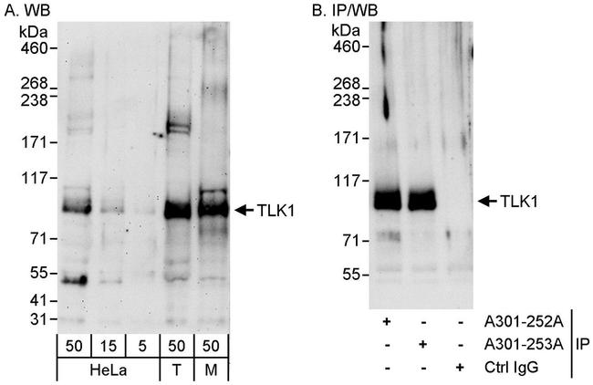 TLK1 Antibody in Western Blot (WB)