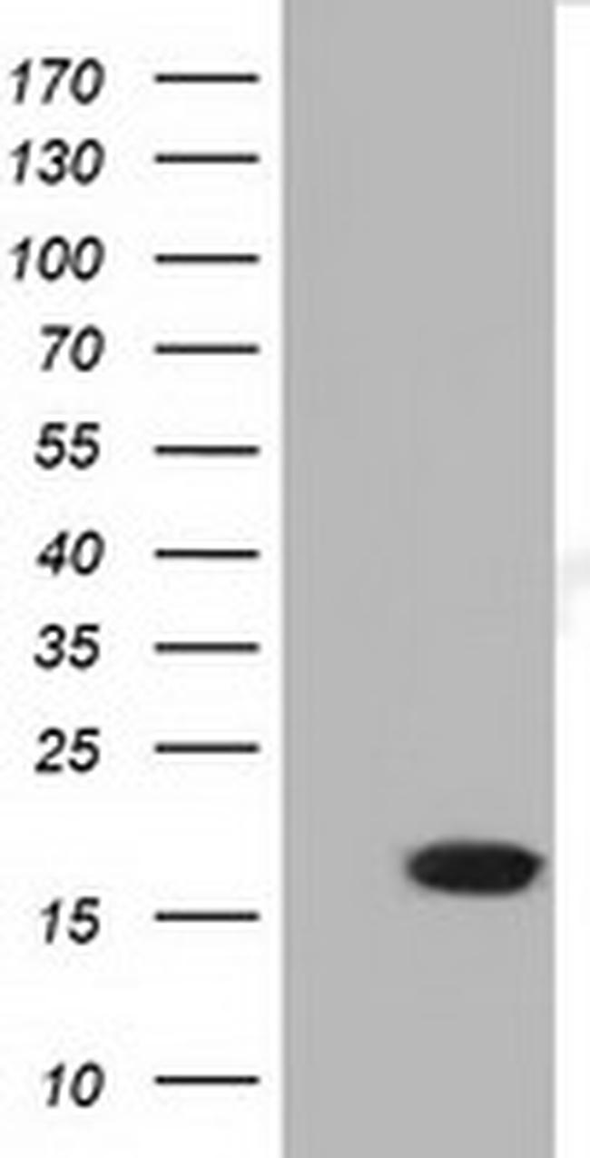 TMEM80 Antibody in Western Blot (WB)