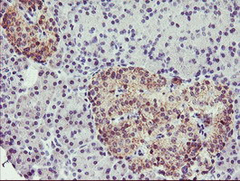 TMOD1 Antibody in Immunohistochemistry (Paraffin) (IHC (P))