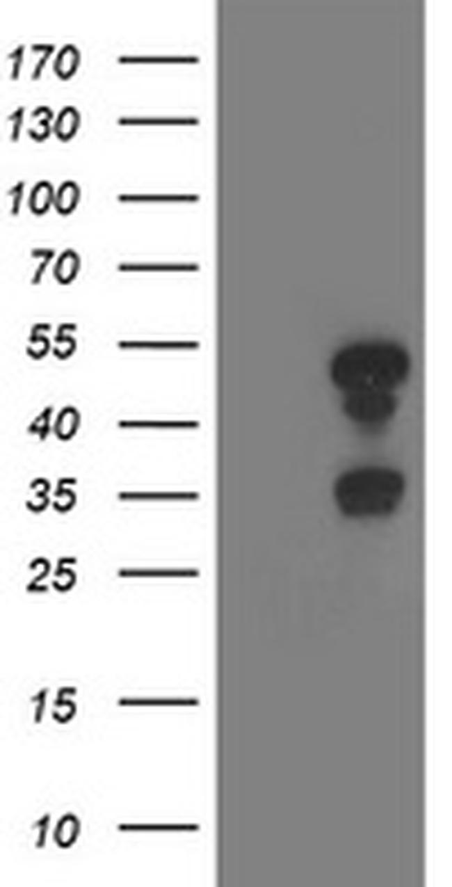 TMOD1 Antibody in Western Blot (WB)