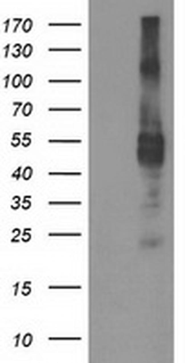 TMPRSS5 Antibody in Western Blot (WB)