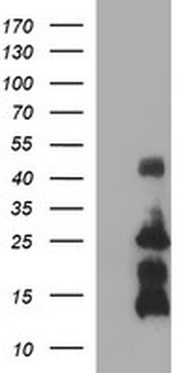 TNFA Antibody in Western Blot (WB)