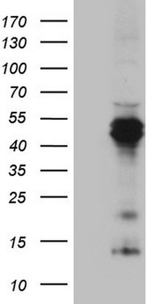 TNFRSF10B Antibody in Western Blot (WB)