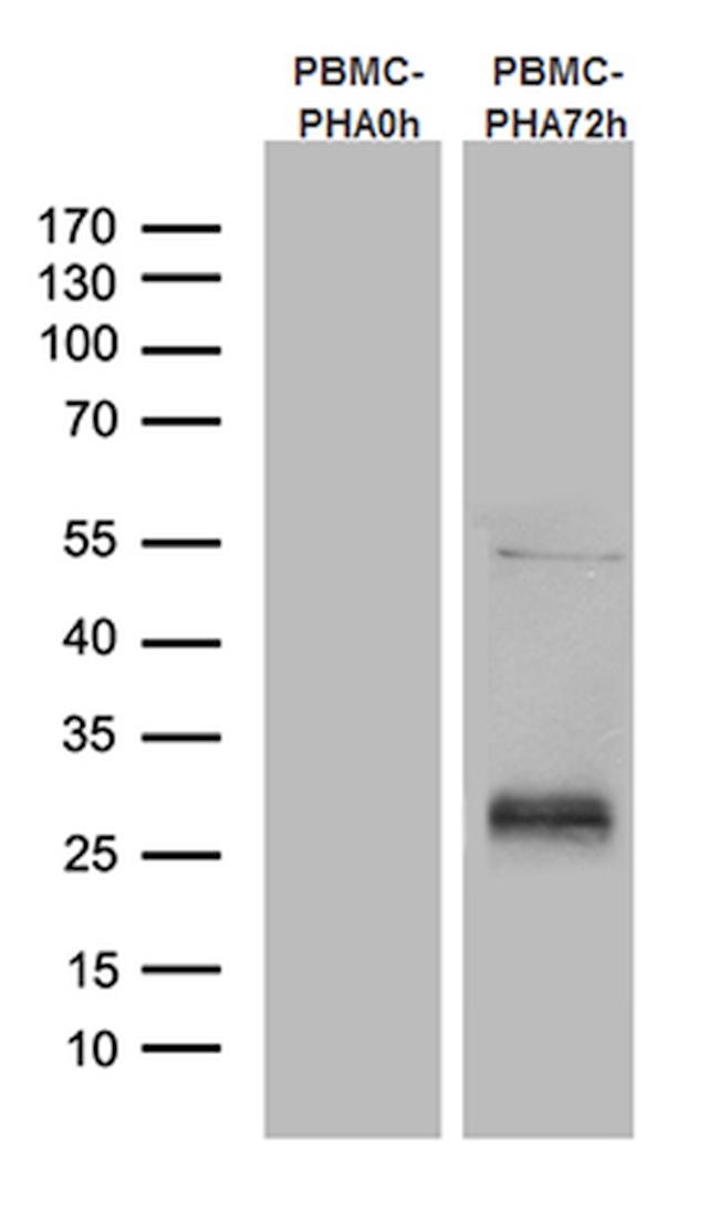 TNFRSF18 Antibody in Western Blot (WB)