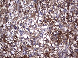 TNFRSF8 Antibody in Immunohistochemistry (Paraffin) (IHC (P))