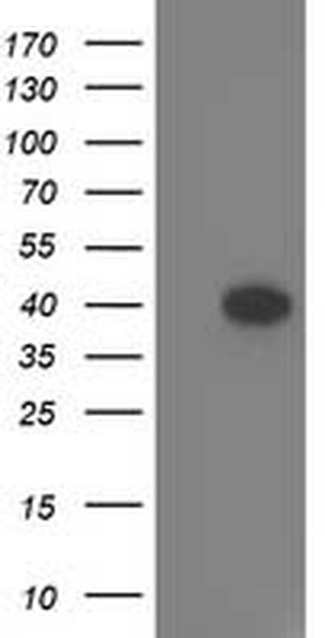TOMM34 Antibody in Western Blot (WB)