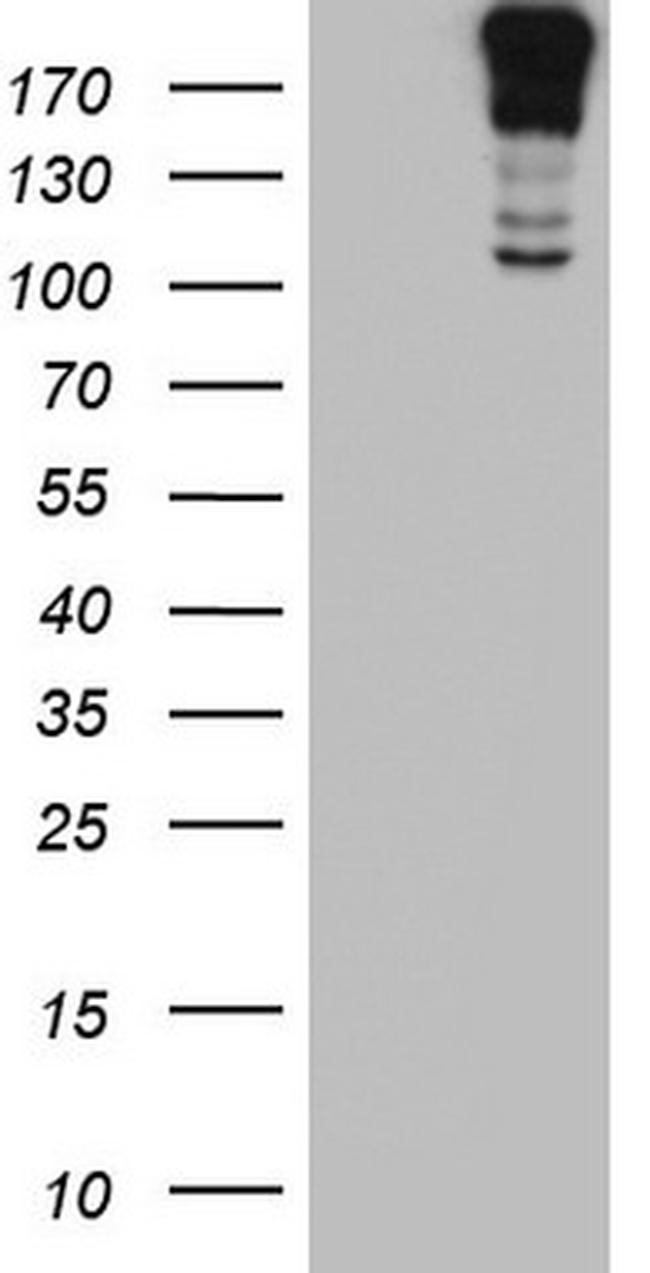 TOP2A Antibody in Western Blot (WB)