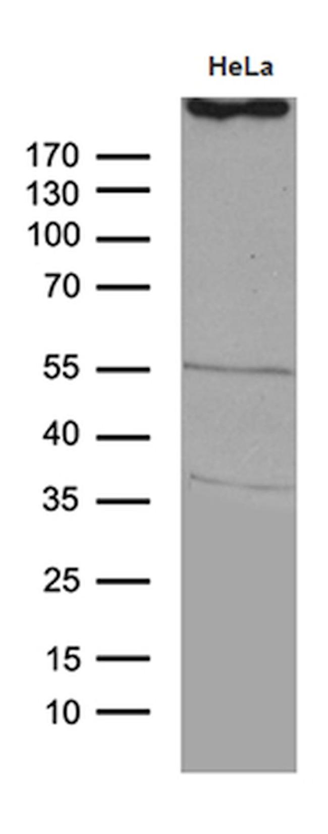 TP53BP1 Antibody in Western Blot (WB)