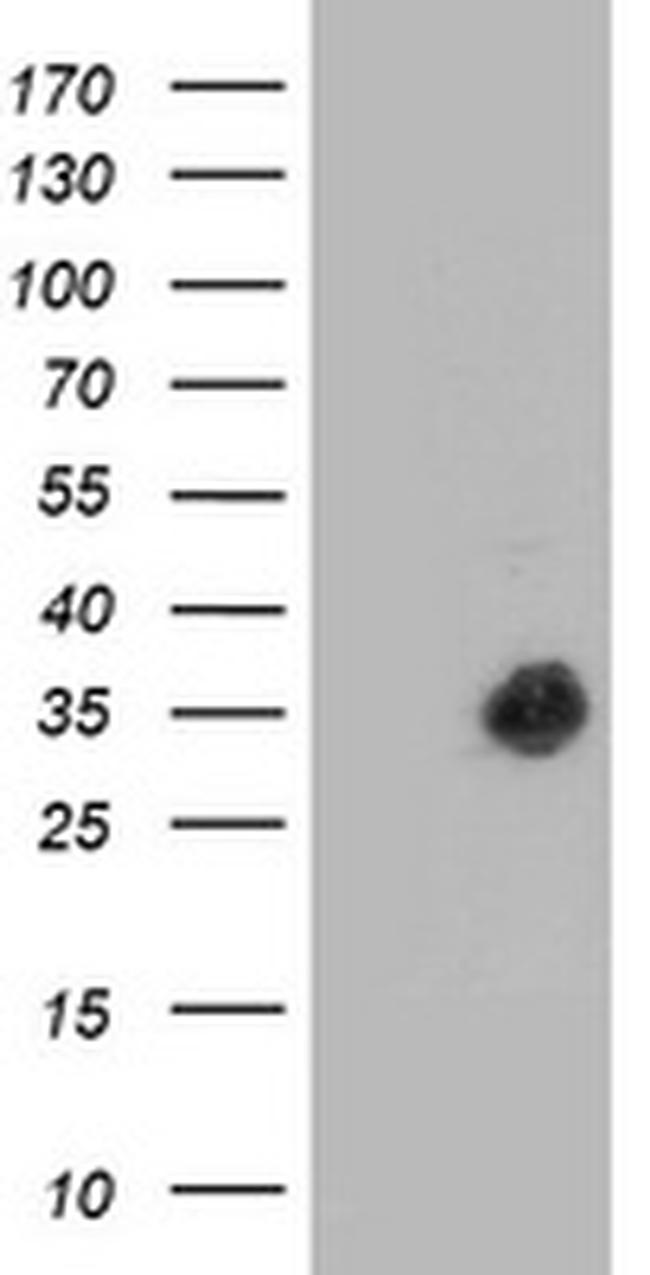 TP53I3 Antibody in Western Blot (WB)