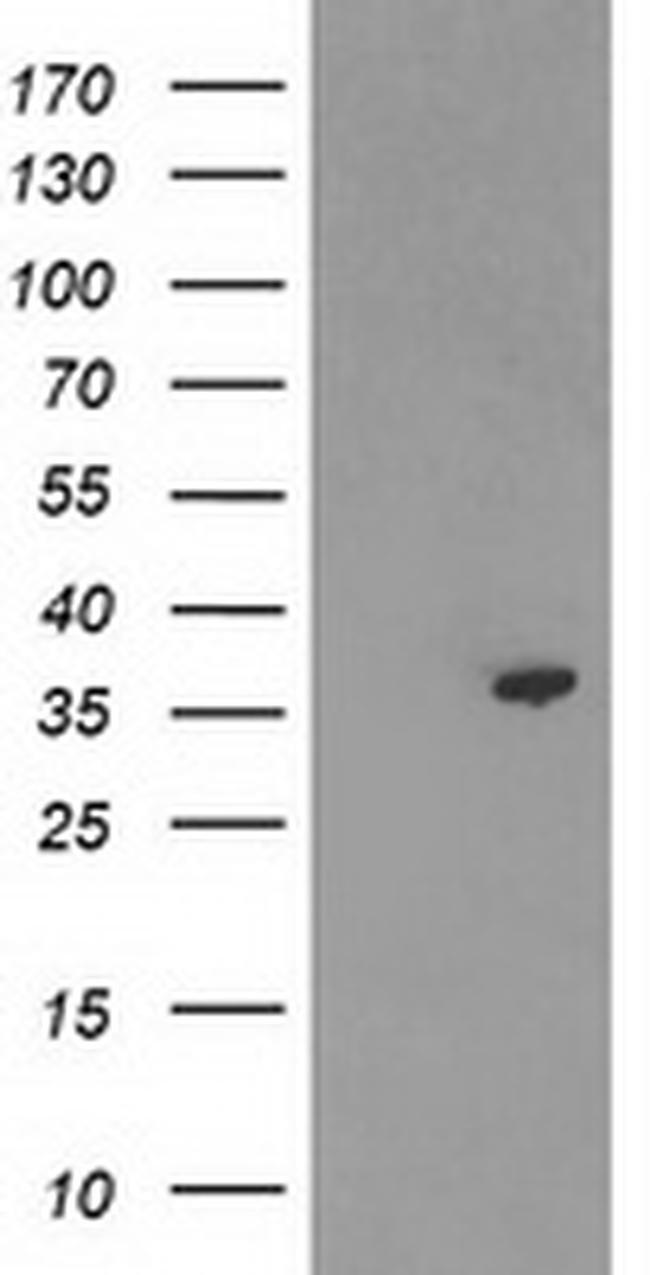 TP53I3 Antibody in Western Blot (WB)