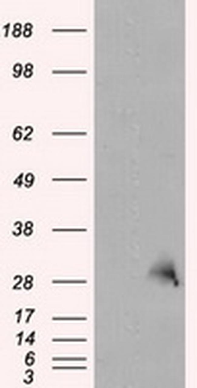 TPMT Antibody in Western Blot (WB)