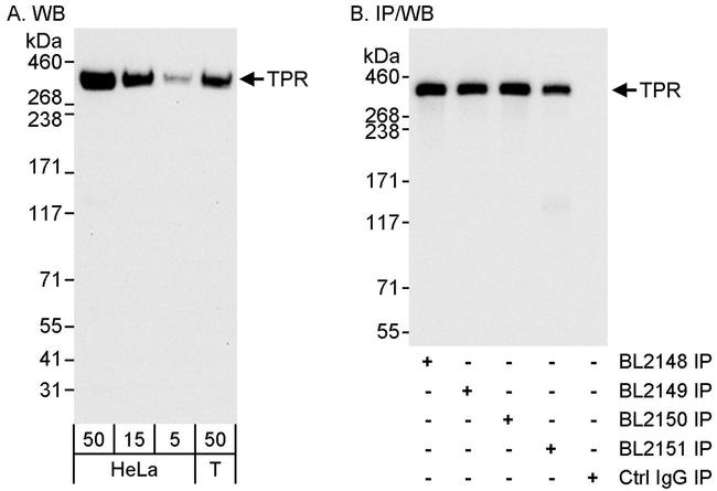 TPR Antibody in Western Blot (WB)