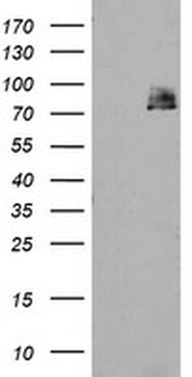 TPRKB Antibody in Western Blot (WB)