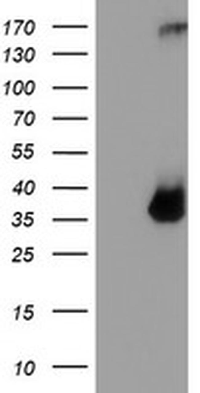TPSG1 Antibody in Western Blot (WB)