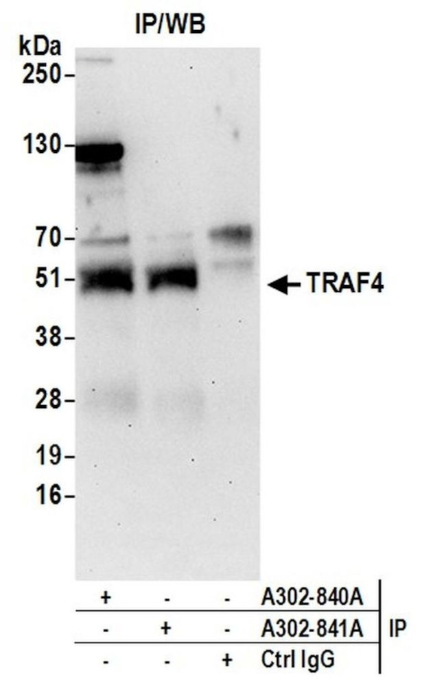TRAF4 Antibody in Immunoprecipitation (IP)