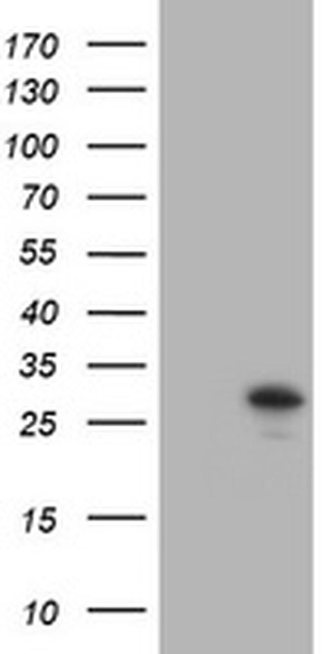TRAPPC4 Antibody in Western Blot (WB)