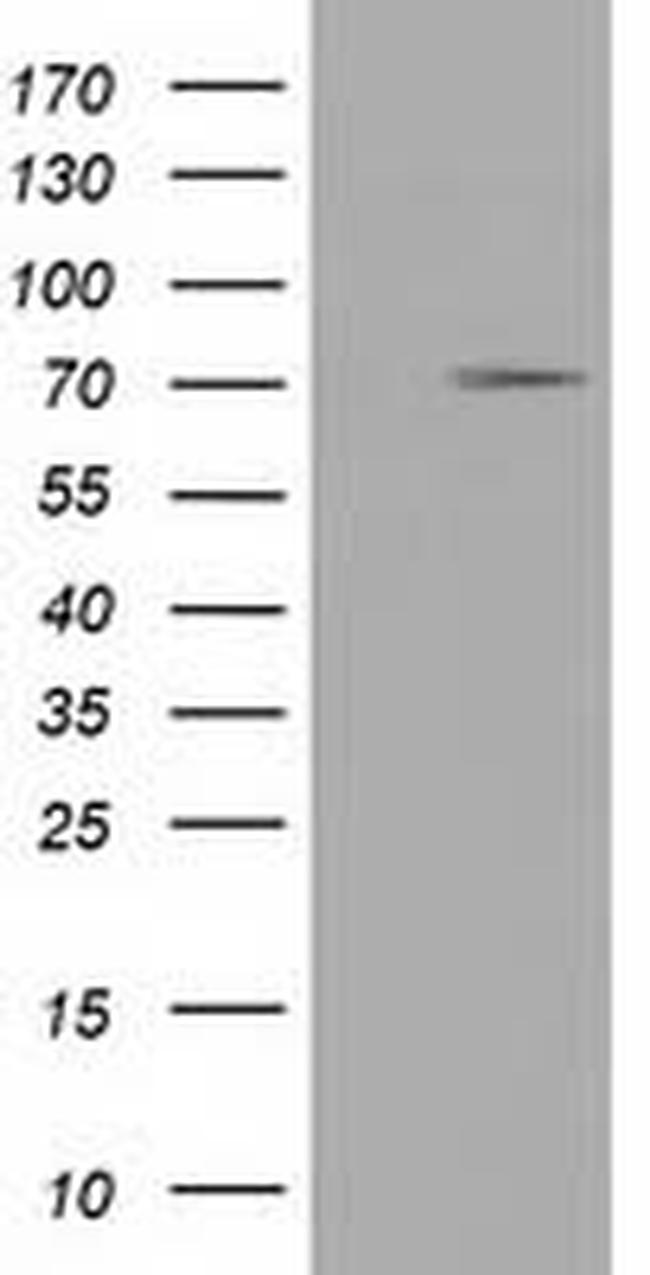 TRIM2 Antibody in Western Blot (WB)