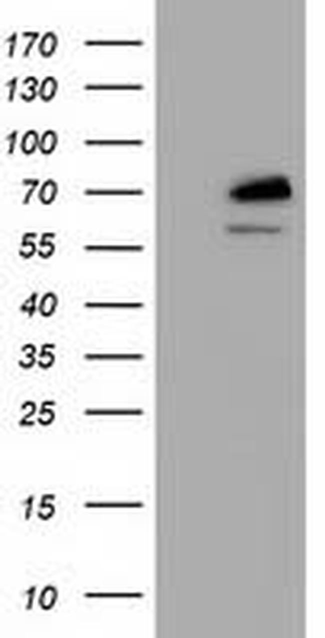 TRIM2 Antibody in Western Blot (WB)