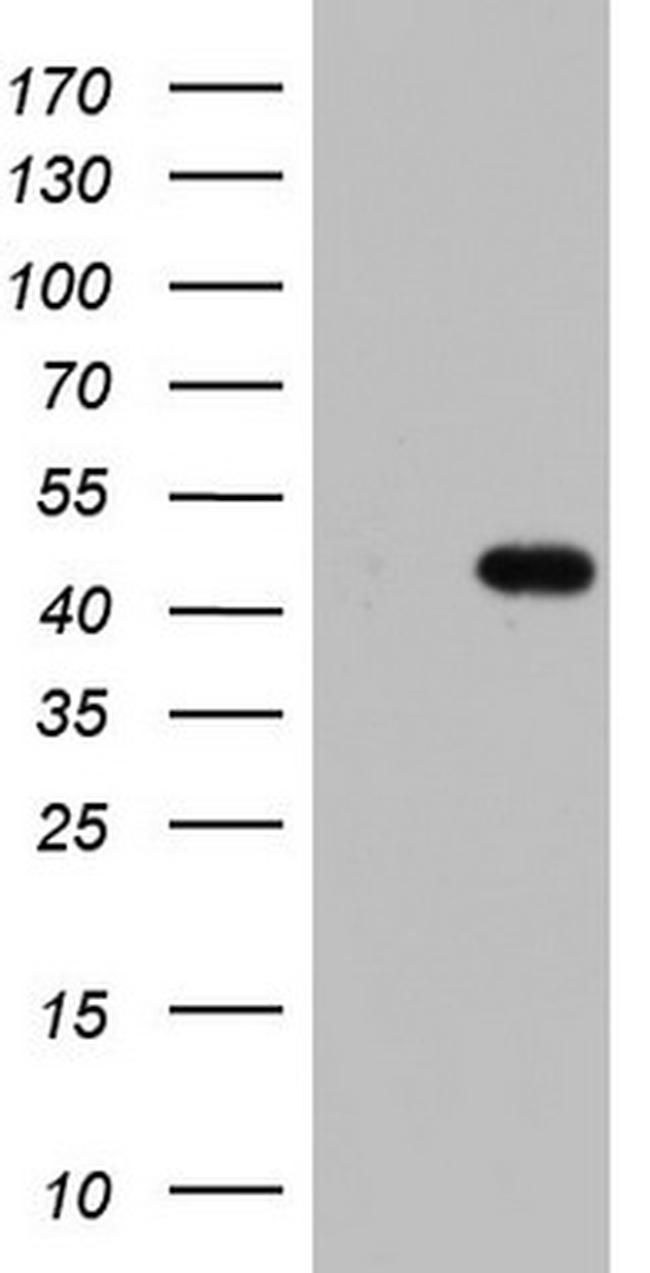 TRIM54 Antibody in Western Blot (WB)