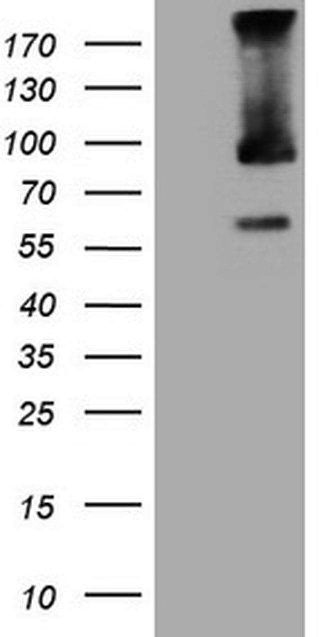 TRIM56 Antibody in Western Blot (WB)