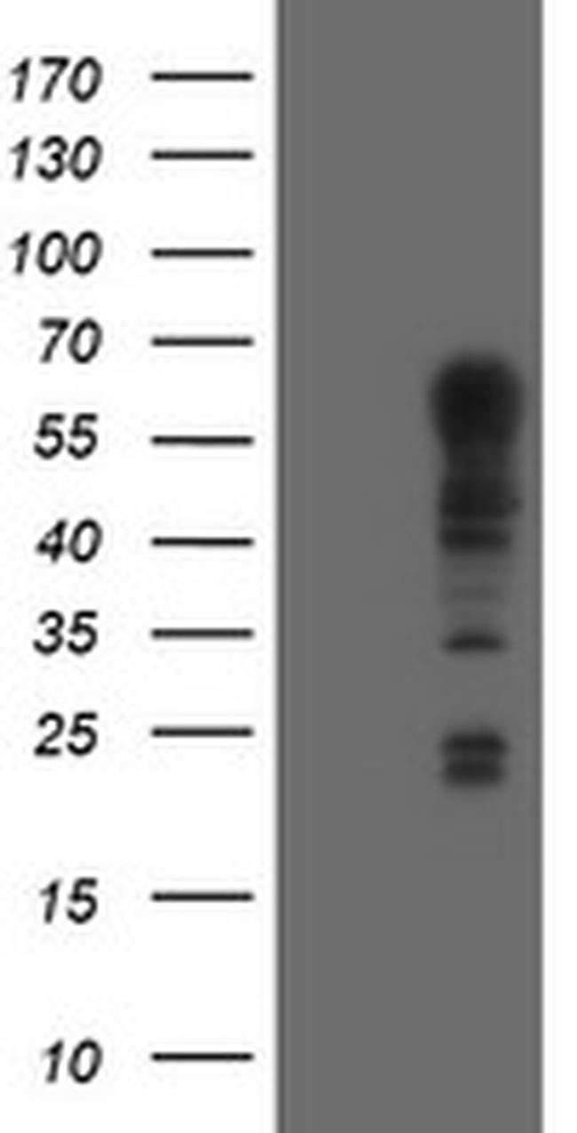 TRIM9 Antibody in Western Blot (WB)