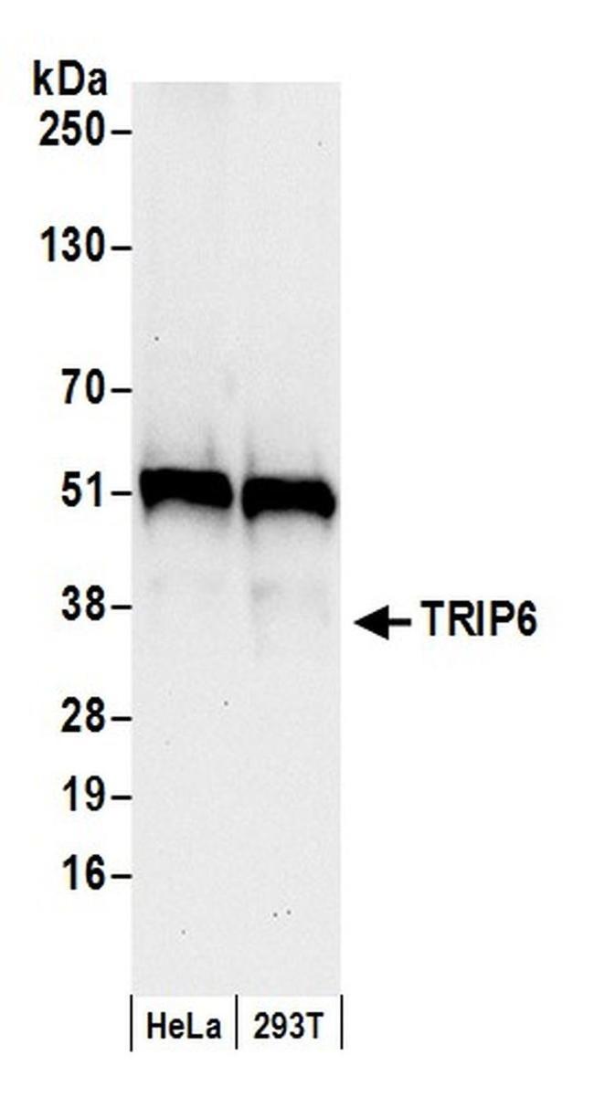 TRIP6 Antibody in Western Blot (WB)