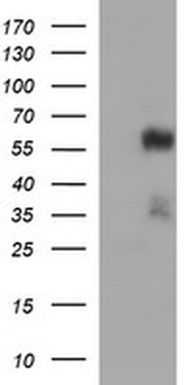 TUBA1B Antibody in Western Blot (WB)