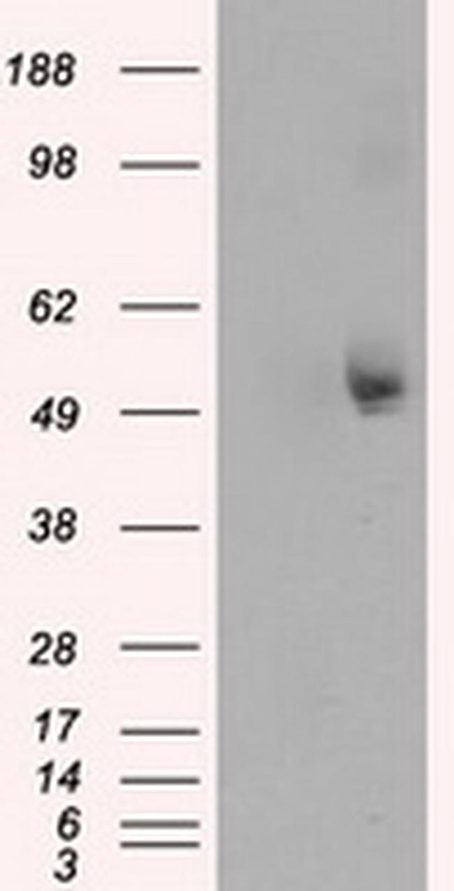 TUBA8 Antibody in Western Blot (WB)