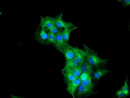 TUBAL3 Antibody in Immunocytochemistry (ICC/IF)