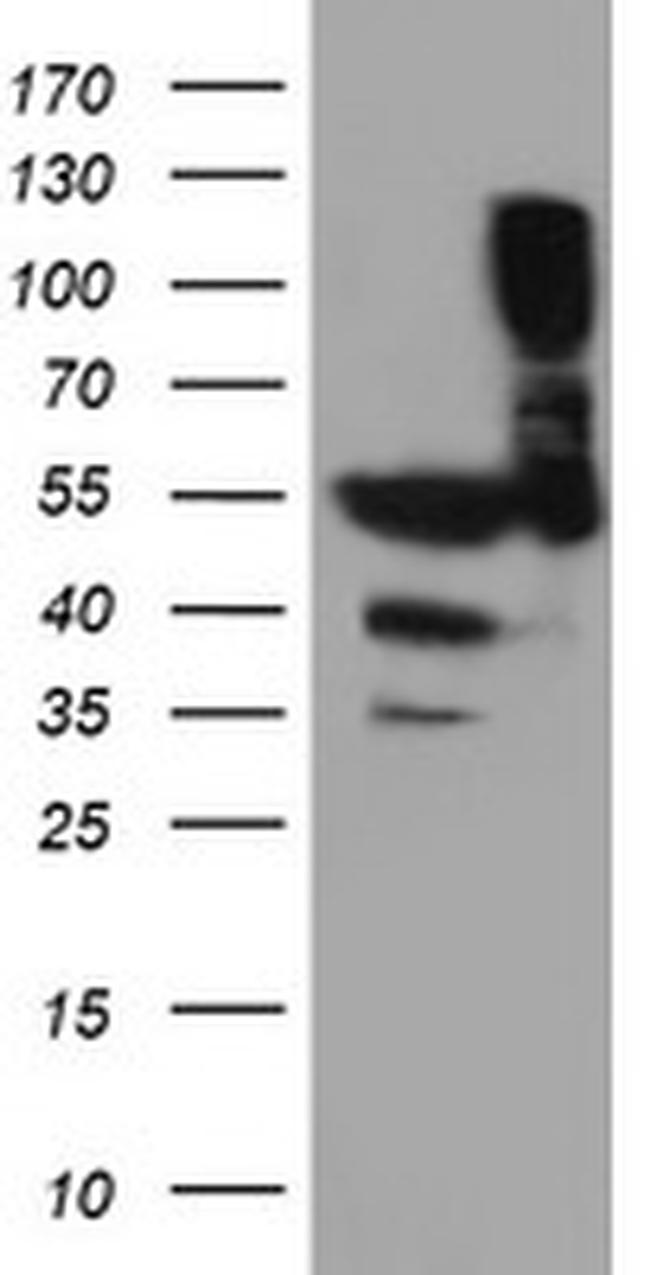 TUBAL3 Antibody in Western Blot (WB)