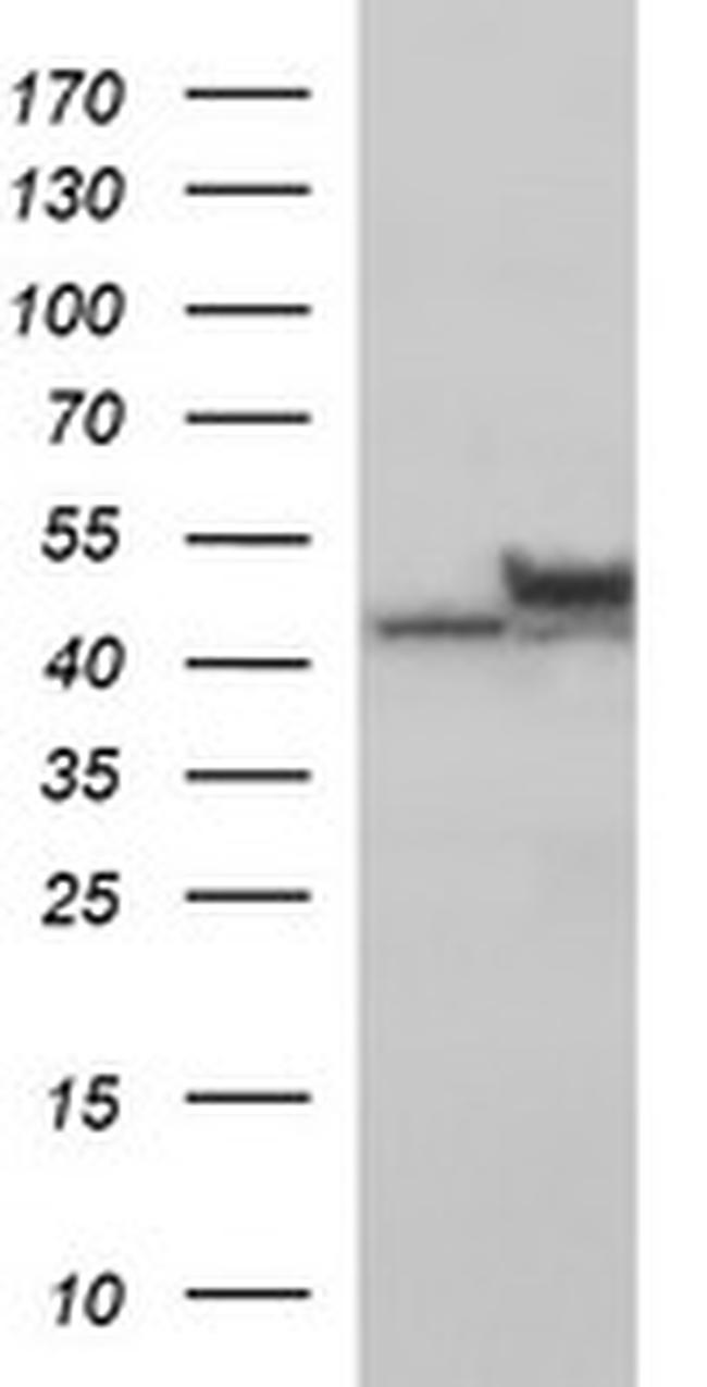 TUBB2B Antibody in Western Blot (WB)