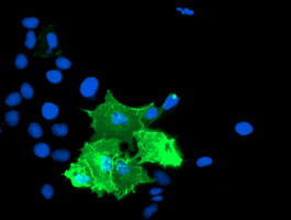 TULP3 Antibody in Immunocytochemistry (ICC/IF)
