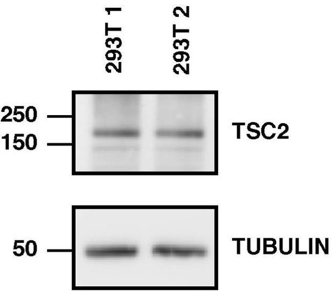 TSC2 Antibody in Western Blot (WB)