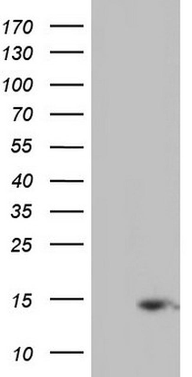 UBA52 Antibody in Western Blot (WB)