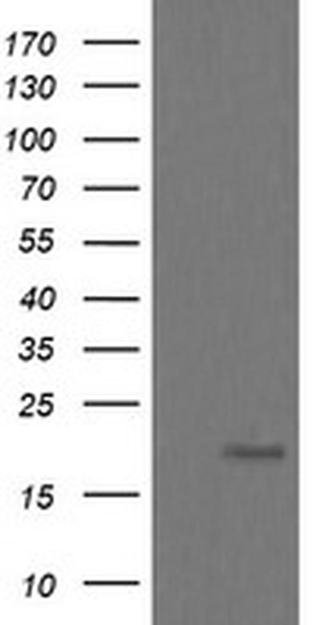 UBE2G2 Antibody in Western Blot (WB)