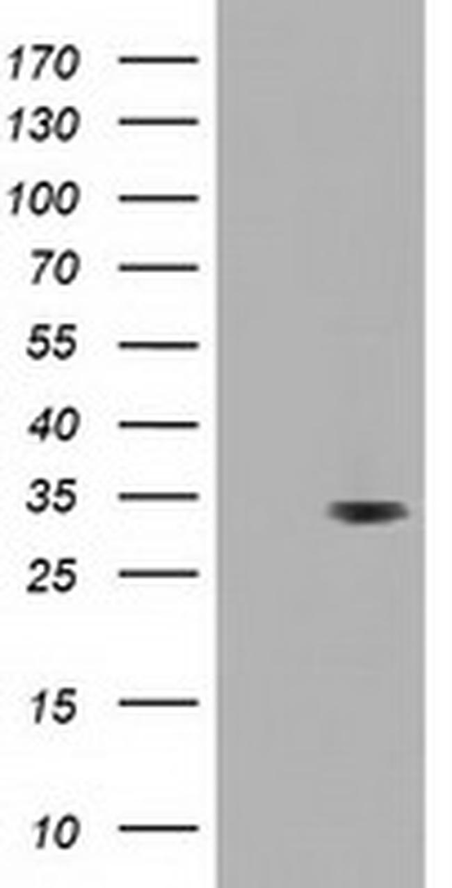 UCK1 Antibody in Western Blot (WB)