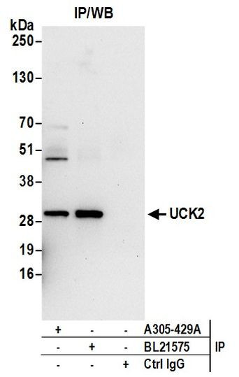UCK2 Antibody in Immunoprecipitation (IP)