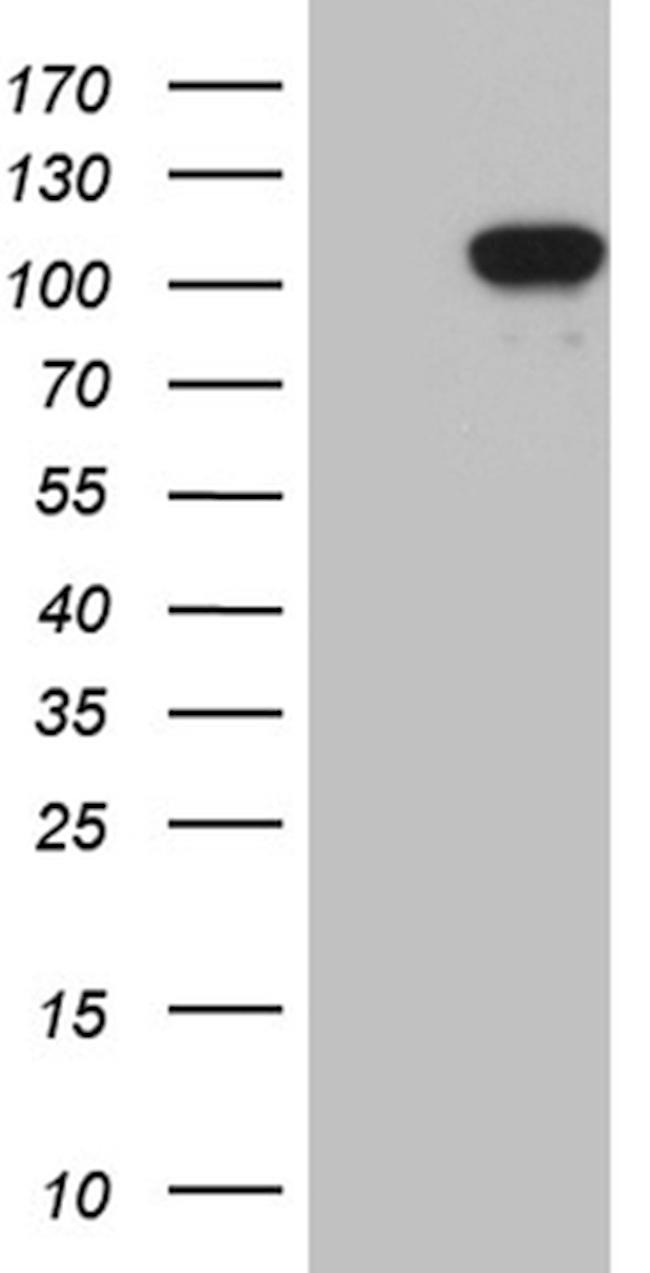 UHRF2 Antibody in Western Blot (WB)