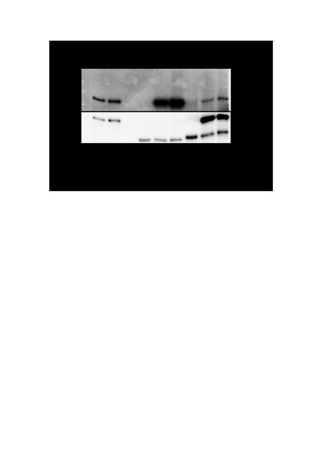 USP17L2 Antibody in Western Blot, Immunoprecipitation (WB, IP)