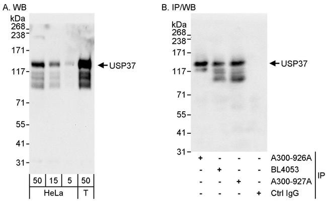 USP37 Antibody in Western Blot (WB)