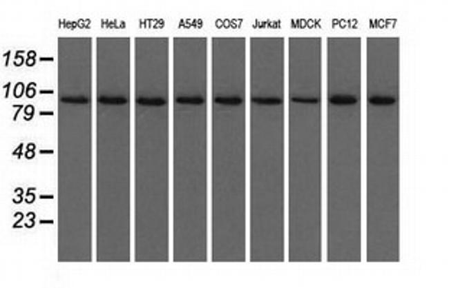 USP5 Antibody in Western Blot (WB)