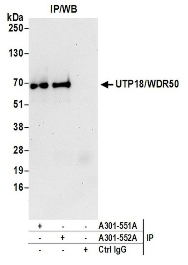 UTP18/WDR50 Antibody in Immunoprecipitation (IP)