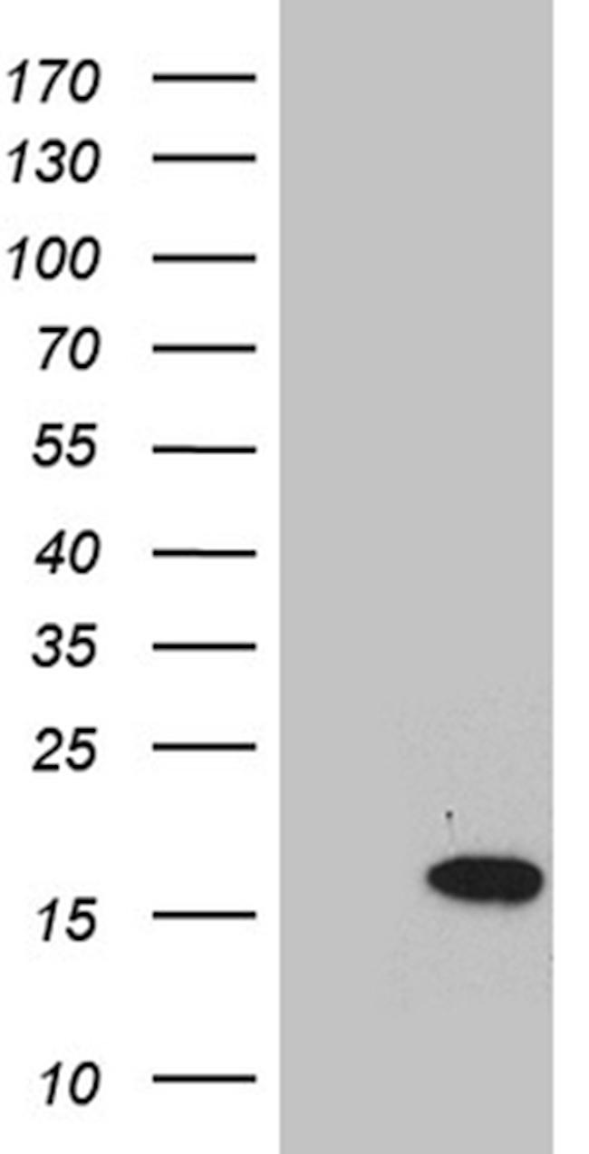 VAMP5 Antibody in Western Blot (WB)
