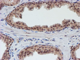 VCAM1 Antibody in Immunohistochemistry (Paraffin) (IHC (P))