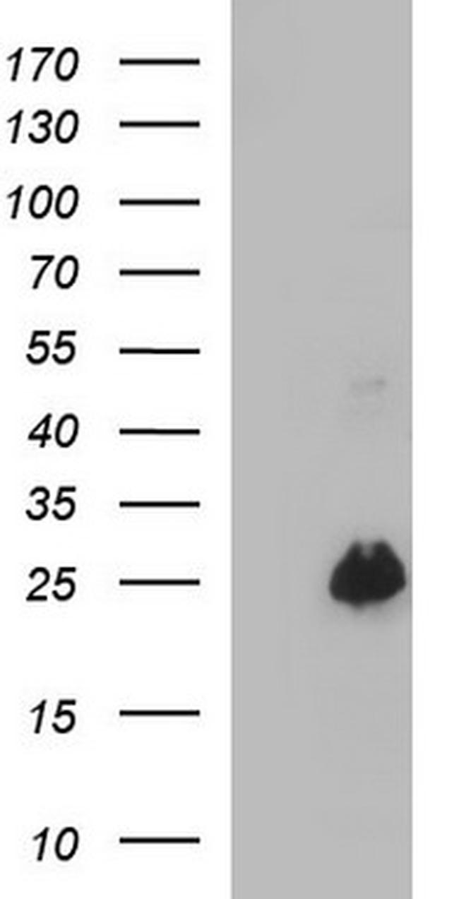 VEGFB Antibody in Western Blot (WB)
