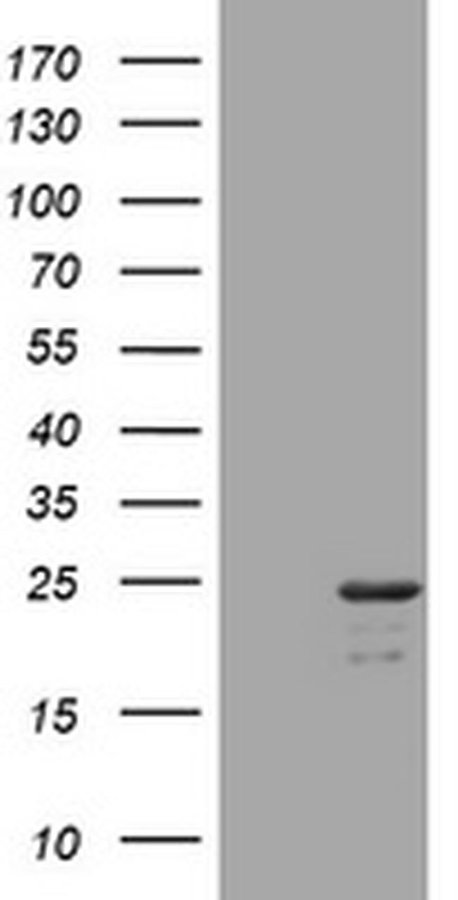 VSNL1 Antibody in Western Blot (WB)